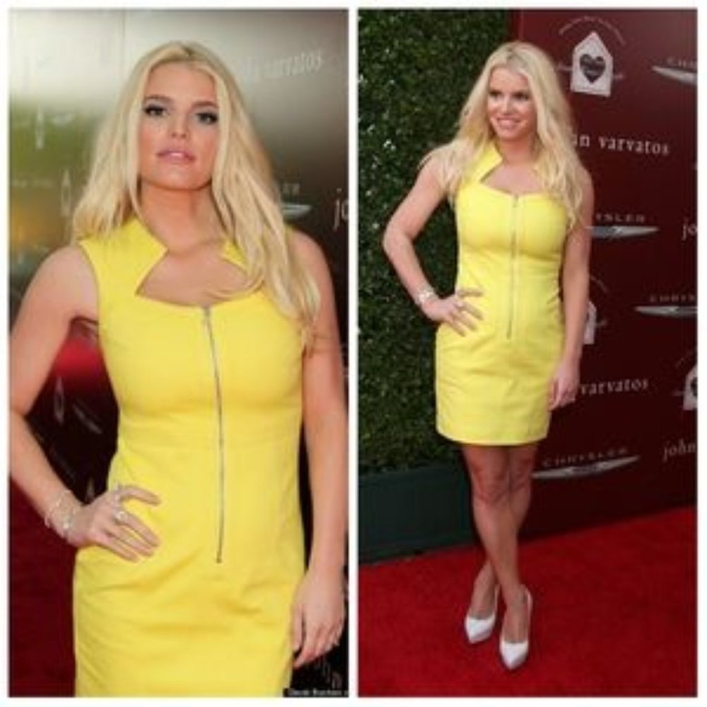 Yigal Azrouel Yellow Geometric Zipper Dress Size 2